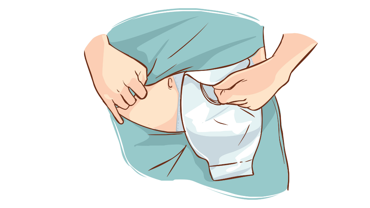 ostomy-placement-and-care-nursing-ce-course-25422a41-a7b6-4a7c-a5c3-9b91b3a0d8c2