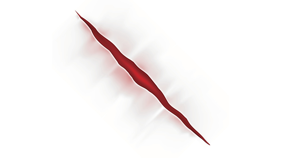 pressure-injuries-nursing-ce-course-21746bea-18d9-406d-9af7-1ba3bcae1855