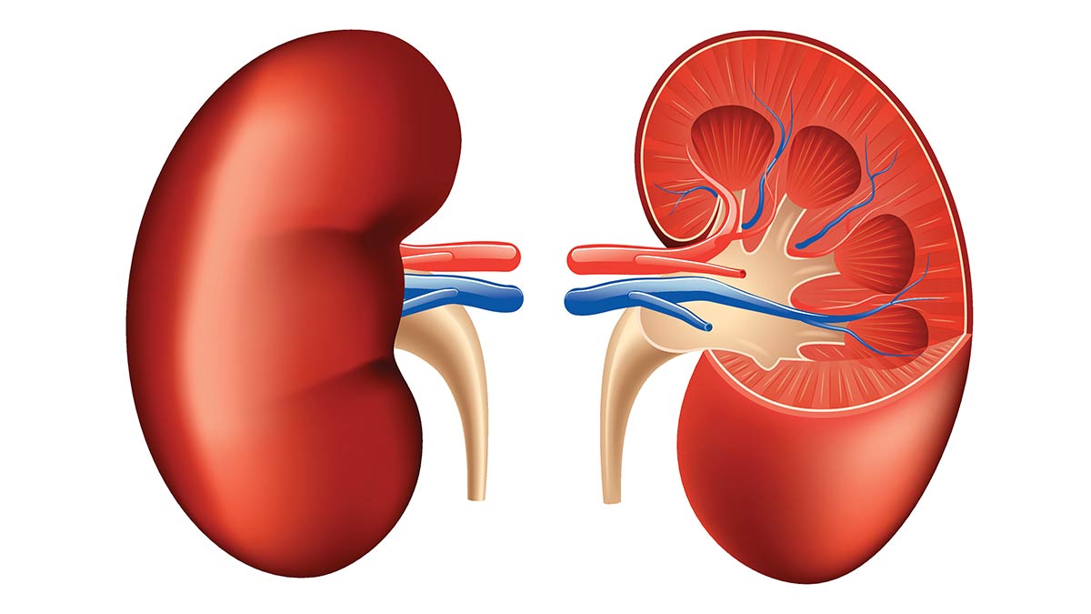 chronic-kidney-disease-nursing-ce-course