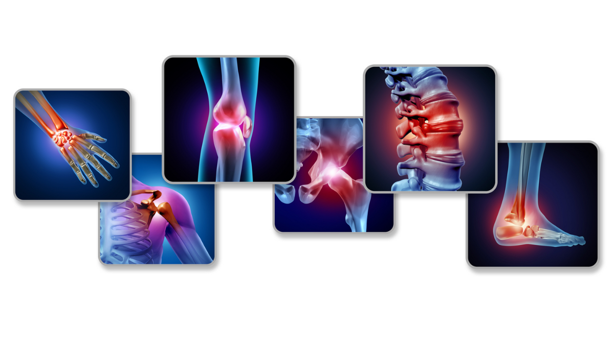 arthritis-nursing-ce-course-for-aprns-18693a49-7811-43ba-9157-75f02d0eb6d5