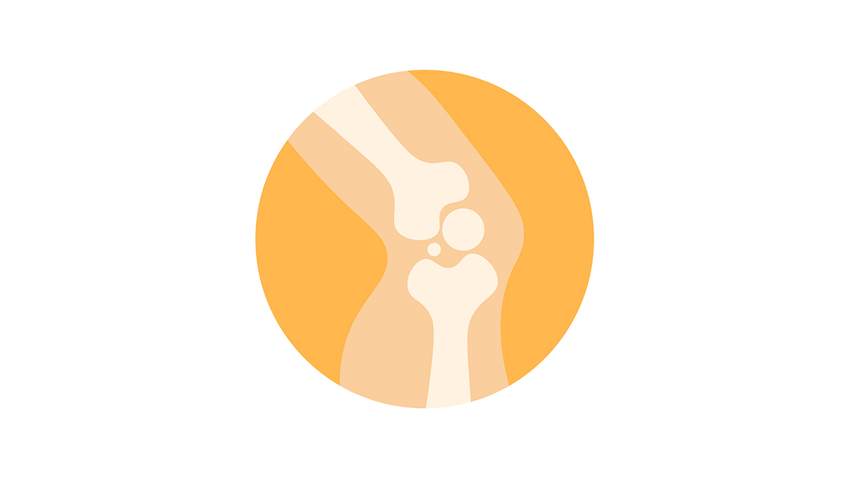 arthritis-nursing-ce-course-for-rns-and-lpns-27297eb1-f82e-4a1b-8fdb-a17493f1cfde