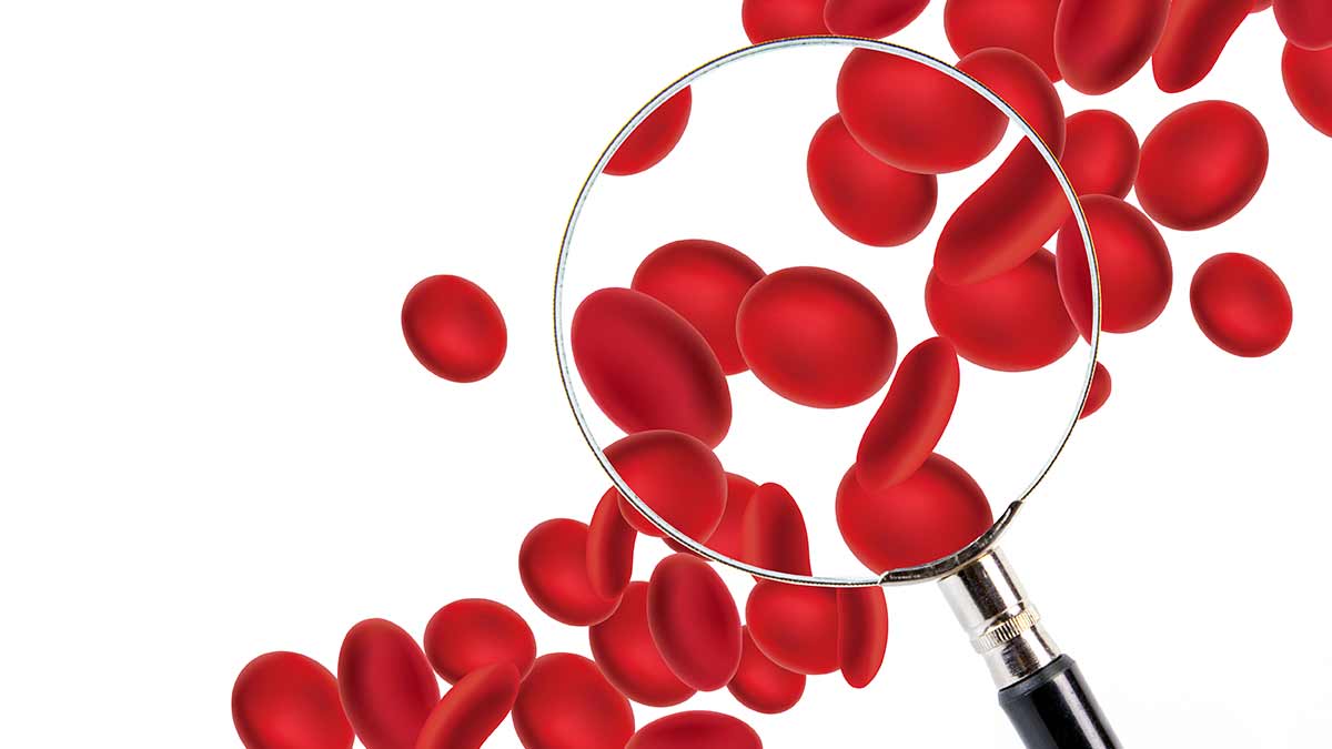 diagnosing-classifying-managing-anemia-in-adults-nursing-ce-course