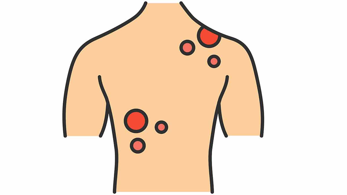 skin-cancer-and-sun-safety-nursing-ce-course