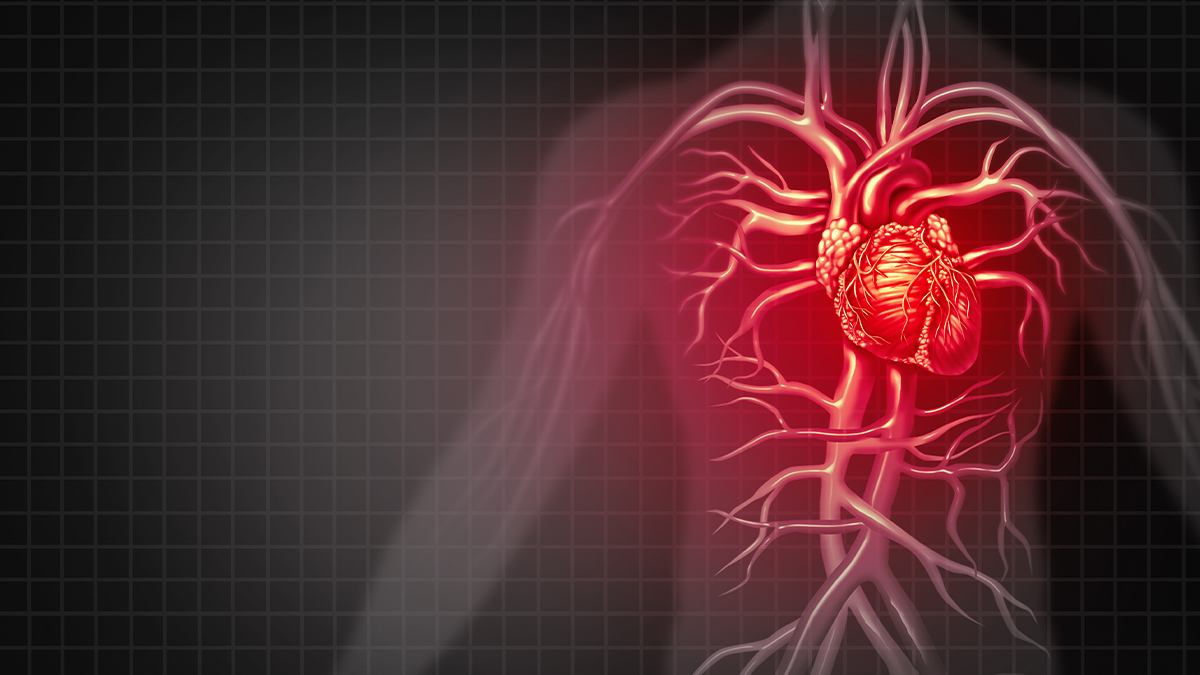 acute-myocardial-infarction-nursing-ce-course-for-rns-and-lpns-bc5326d2-45dd-4fec-bf40-0c1989df1a20