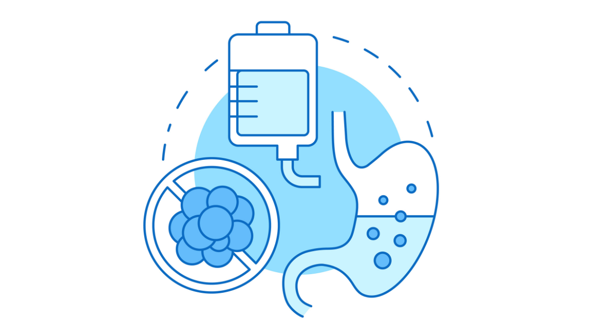 Nutritional Support in Critical Illness Enteral and Parenteral