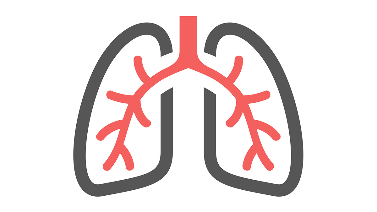 pneumonia