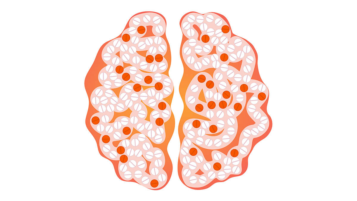 multiple-sclerosis