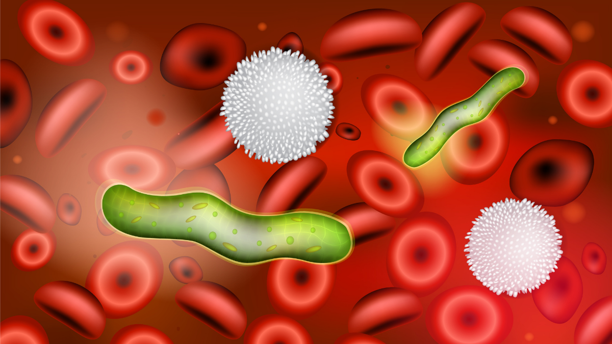 overview-of-sepsis-nursing-ce-course-for-aprns